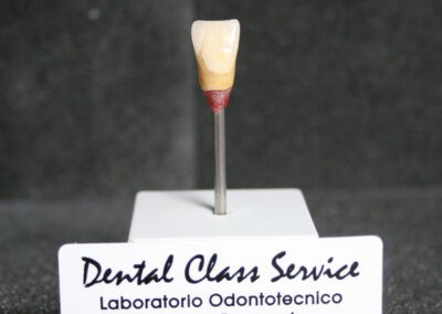 dental class service lavori eseguiti centrale in ceramica