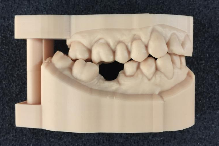 Modelli dentali: caratteristiche e tipologie